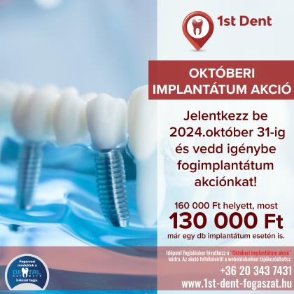 Októberi Implantátum Akció